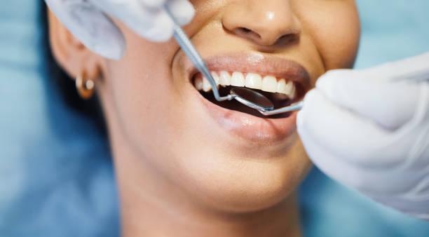 Urgent Tooth Repair in NC